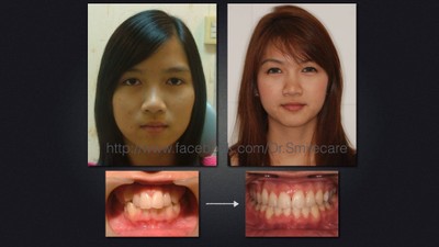 ตัวอย่างเคส