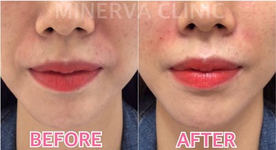 Minerva Clinic (มิเนอร์วาคลินิก) สยามพารากอน Minerva Clinic (มิเนอร์วาคลินิก) สยามพารากอน