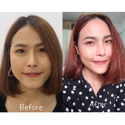 ลดกราม