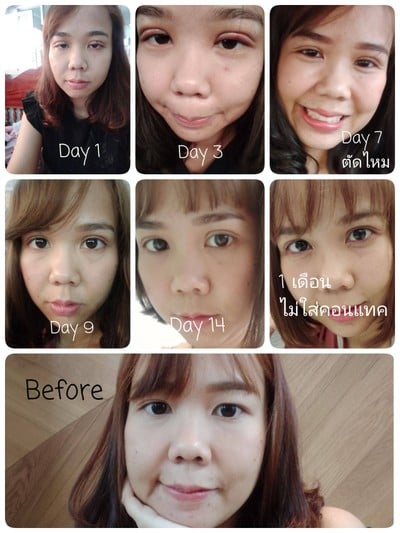 SLC Siam Laser Clinic (สยามเลเซอร์ คลินิก) ทองหล่อ SLC Siam Laser Clinic (สยามเลเซอร์ คลินิก) ทองหล่อ