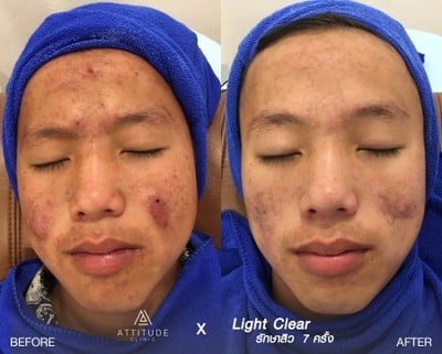 Attitude Clinic เชียงราย เชียงราย