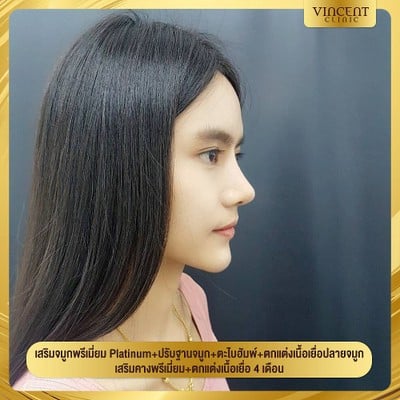 Vincent Clinic  อมตะนคร