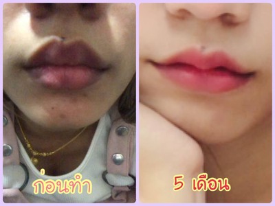 บริการหรือผลลัพธ์ที่ได้