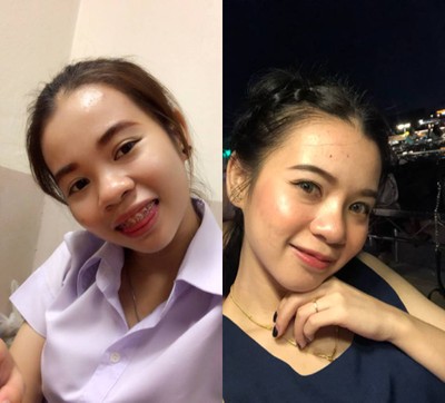 บริการหรือผลลัพธ์ที่ได้