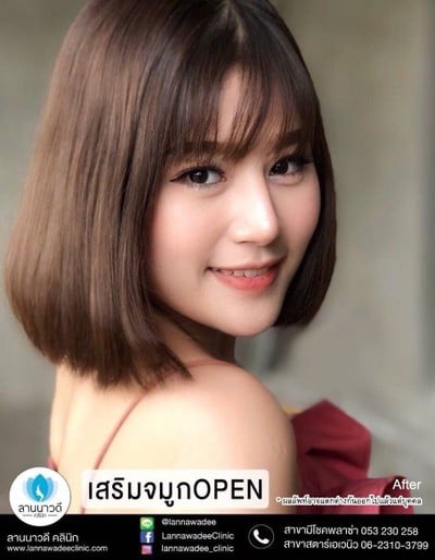 ลานนาวดีคลีนิค มีโชคพลาซ่า