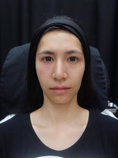 Amarante Clinic บางนา : For You Park