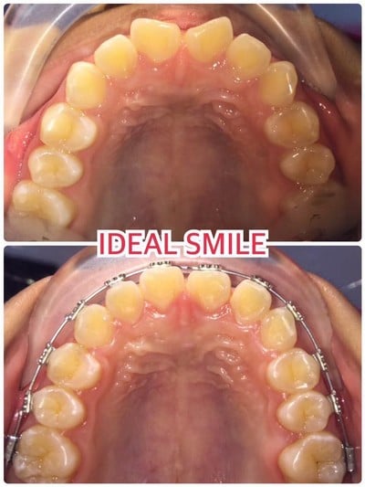 https://www.facebook.com/idealsiam/