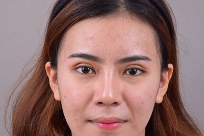 โรงพยาบาลมาสเตอร์พีช