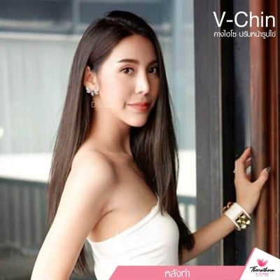 YKJ Medical Center by ธีระธรฌ์คลินิก