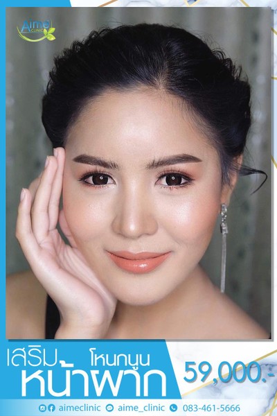 Aime' Clinic ลาดพร้าว