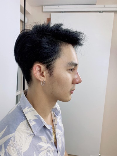 รีวิวเสริมจมูกผู้ชาย