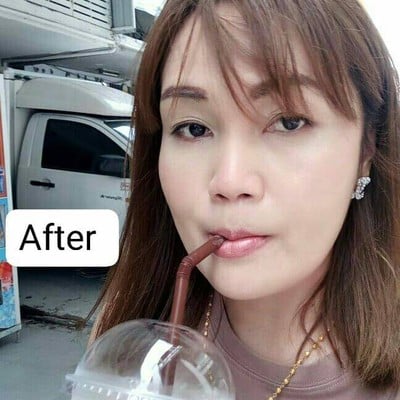 Proderma (โพรเดอร์มาคลินิก) Proderma (โพรเดอร์มาคลินิก)
