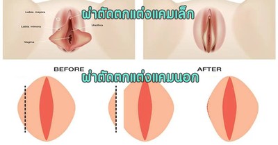 รีวิว โรงพยาบาลมาสเตอร์พีช - หมดปัญหาเรื่องน้องสาว เคล็ดลับ ทำแล้วต้องรัก !