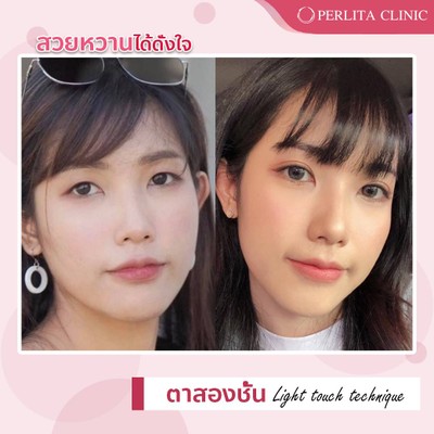 บริการหรือผลลัพธ์ที่ได้