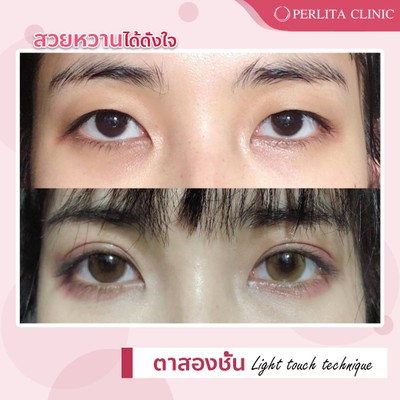 บริการหรือผลลัพธ์ที่ได้