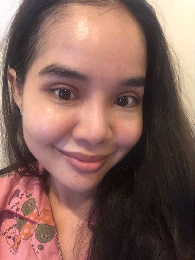 Lovely Eye and Skin Clinic The Crystal Park เลียบด่วน-รามอินทรา Lovely Eye and Skin Clinic The Crystal Park เลียบด่วน-รามอินทรา