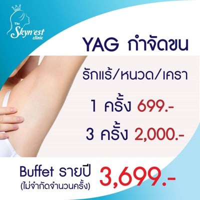 รีวิว Sky'nest Clinic ประชาสงเคราะห์ ห้วยขวาง - กำจัดขนด้วย YAG ประทับใจ รีวิว Sky'Nest Clinic ประชาสงเคราะห์ ห้วยขวาง - กำจัดขนด้วย Yag ประทับใจ