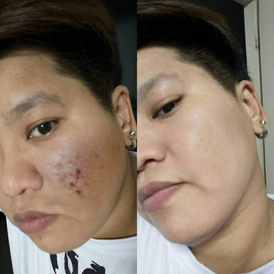 M Vita Clinic - คลินิกรักษาสิว Asoke Montri