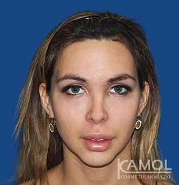 Kamol Cosmetic Hospital