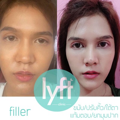 flyff clinic สาขานิคม 304 ปราจีนบุรี สาขานิคม 304 ปราจีนบุรี flyff clinic สาขานิคม 304 ปราจีนบุรี สาขานิคม 304 ปราจีนบุรี