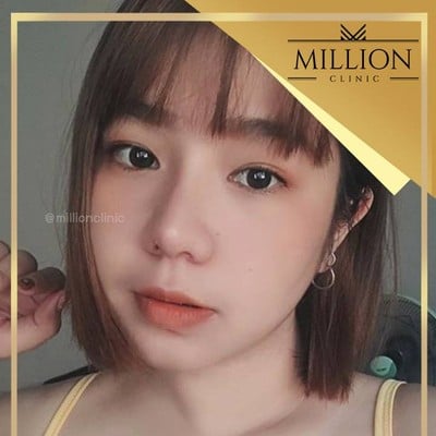 Million Clinic พัทยา