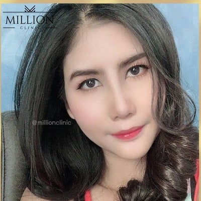 Million Clinic พัทยา