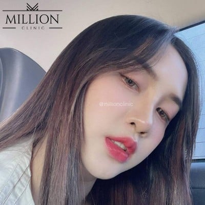 Million Clinic พัทยา