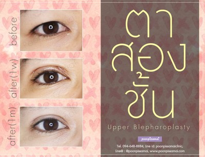 บริการหรือผลลัพธ์ที่ได้