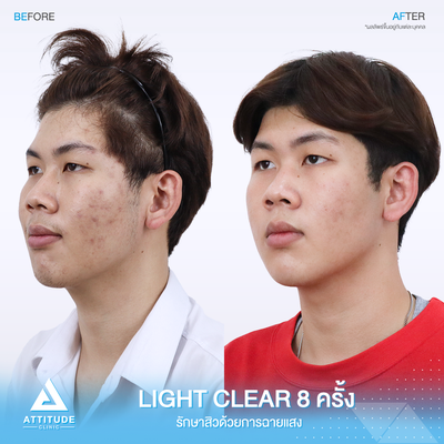 ATTITUDE CLINIC (แอททิจูดคลินิก) เชียงใหม่ ATTITUDE CLINIC (แอททิจูดคลินิก) เชียงใหม่