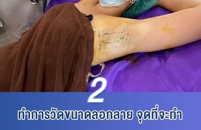 The Skin Clinic เมเจอร์ปิ่นเกล้า