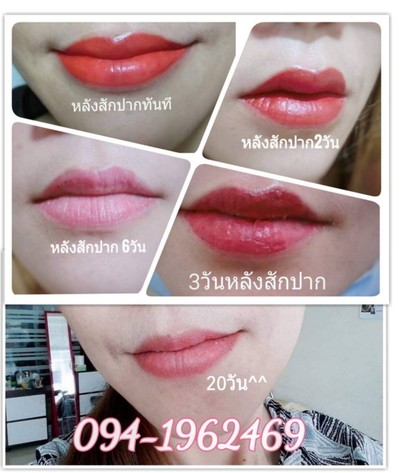 บริการหรือผลลัพธ์ที่ได้
