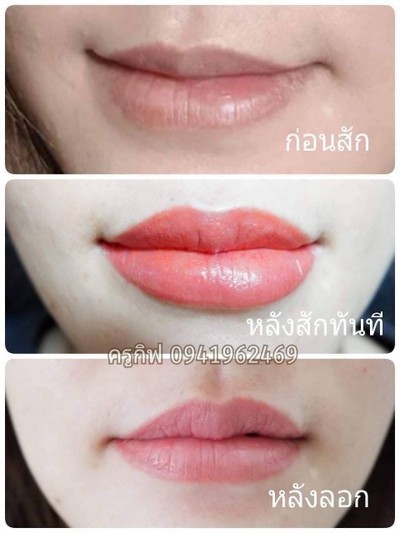 บริการหรือผลลัพธ์ที่ได้