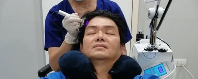 Million Hair Transplant Center