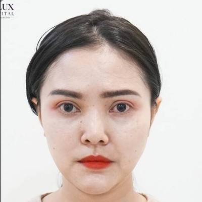 โรงพยาบาลเลอลักษณ์  (LELUX Hospital)