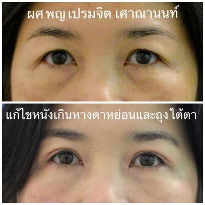 เศาณานนท์คลินิก ทองหล่อ