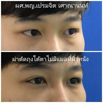 เศาณานนท์คลินิก ทองหล่อ