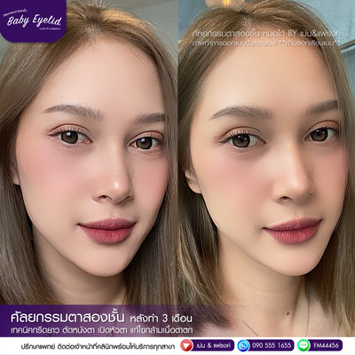 บริการหรือผลลัพธ์ที่ได้