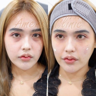 เมนูของร้าน Amenla clinic เอเมนร่าคลินิก นครศรีธรรมราช