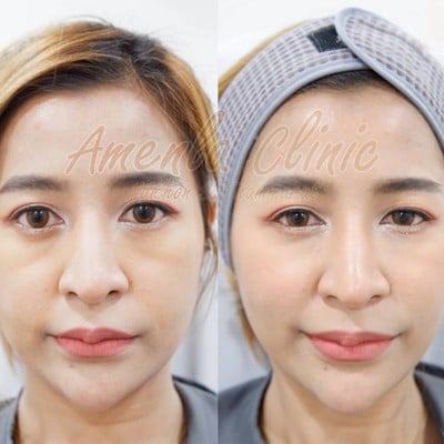 เมนูของร้าน Amenla clinic เอเมนร่าคลินิก นครศรีธรรมราช