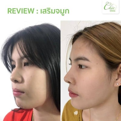 Chic Clinic อุตรดิตถ์
