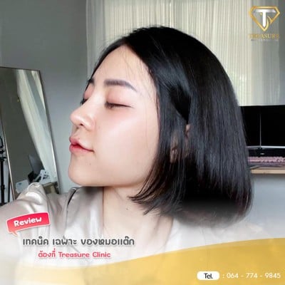 Treasure Clinic เชียงใหม่