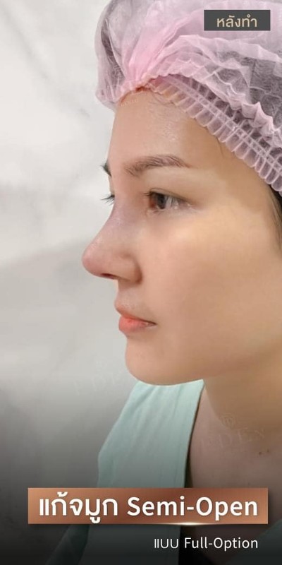 อีเดน คลีนิก E-DEn Clinic (อีเดน คลีนิก) เชียงใหม่
