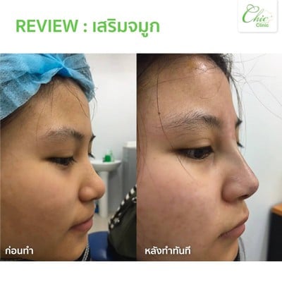 Chic Clinic อุตรดิตถ์