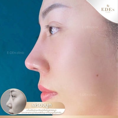 อีเดน คลีนิก E-DEn Clinic (อีเดน คลีนิก) เชียงใหม่