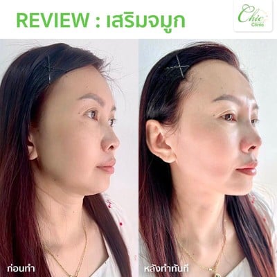 Chic Clinic อุตรดิตถ์