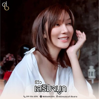 คลินิกหมอแบงค์ เชียงราย แก้จมูก เสริมจมูก Botox Filler ร้อยไหม