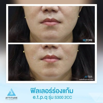 เมนูของร้าน Attitude Clinic  ห้วยขวาง