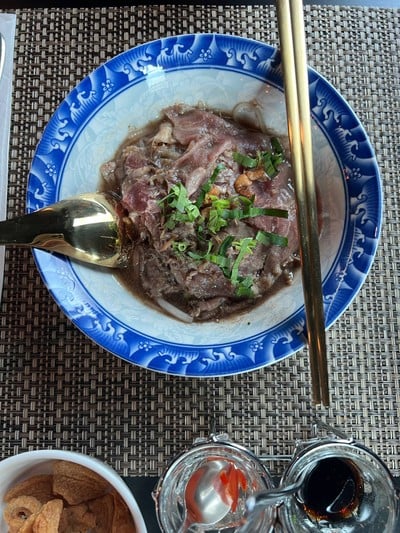 เส้นเล็กสันคอ