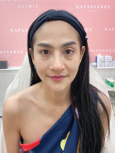 Napassaree Clinic อ่อนนุช