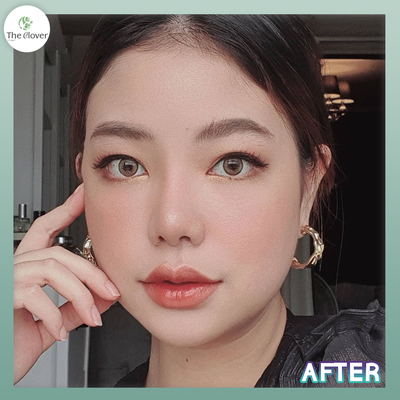 The Clover Clinic Siam Square One